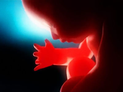Clonage d'un enfant