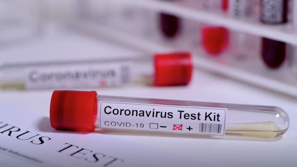 Coronavirus Test Kit