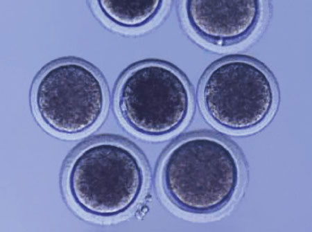 Ovocytes
