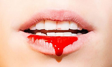 Sang sur les lèvres