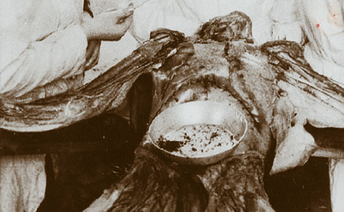 Souillure - dissection cadavre